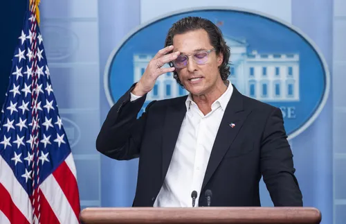 Матю Макконъхи сподели снимка на подутото си око след ужилване от пчела